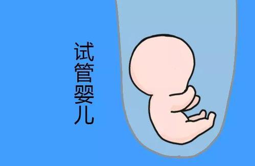 顕微授精 ICSI